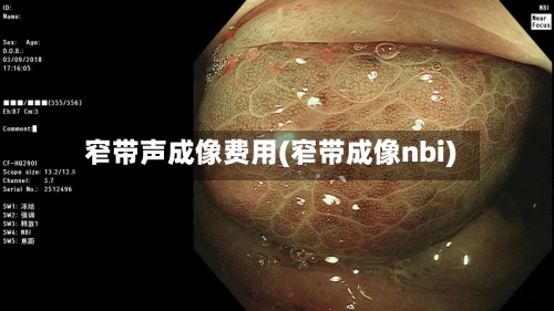 窄带声成像费用(窄带成像nbi)-第2张图片