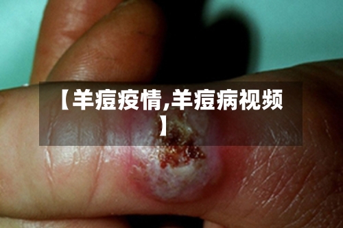 【羊痘疫情,羊痘病视频】-第2张图片